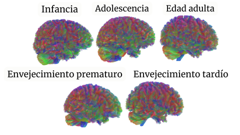 Im�genes representativas de tractograf�a por resonancia magn�tica de todas las �pocas del cerebro humano. El cerebro humano pasa por cinco grandes etapas a lo largo de la vida.