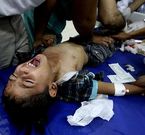 Los mdicos palestinos atienden a un nio herido en el bombardeo al hospital. 