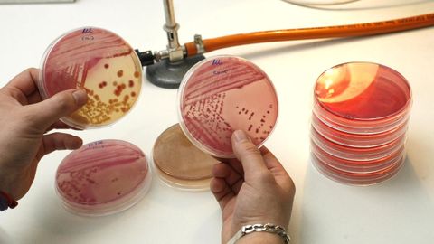 Una  muestra de la bacteria  E. coli , responsable de la muerte de casi un  millón de personas