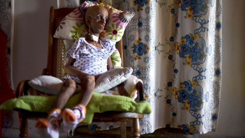 Magali Gonzlez Sierra, una nia con progeria que celebra su 15 cumpleaos