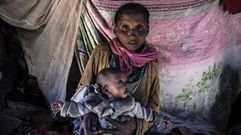 Una madre sostiene a su hija desnutrida en Amboasary, Madagascar, uno de los pases ms pobres del planeta.