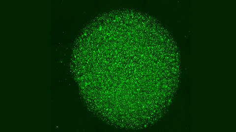 Imagen de microscopia confocal fluorescente. Se trata de la biocápsula cargada de células CAR-T (es decir, linfocitos T modificados genéticamente) que se acaban liberando cerca del tumor permitiendo un ataque directo a las células cancerosas, como un caballo de Troya.