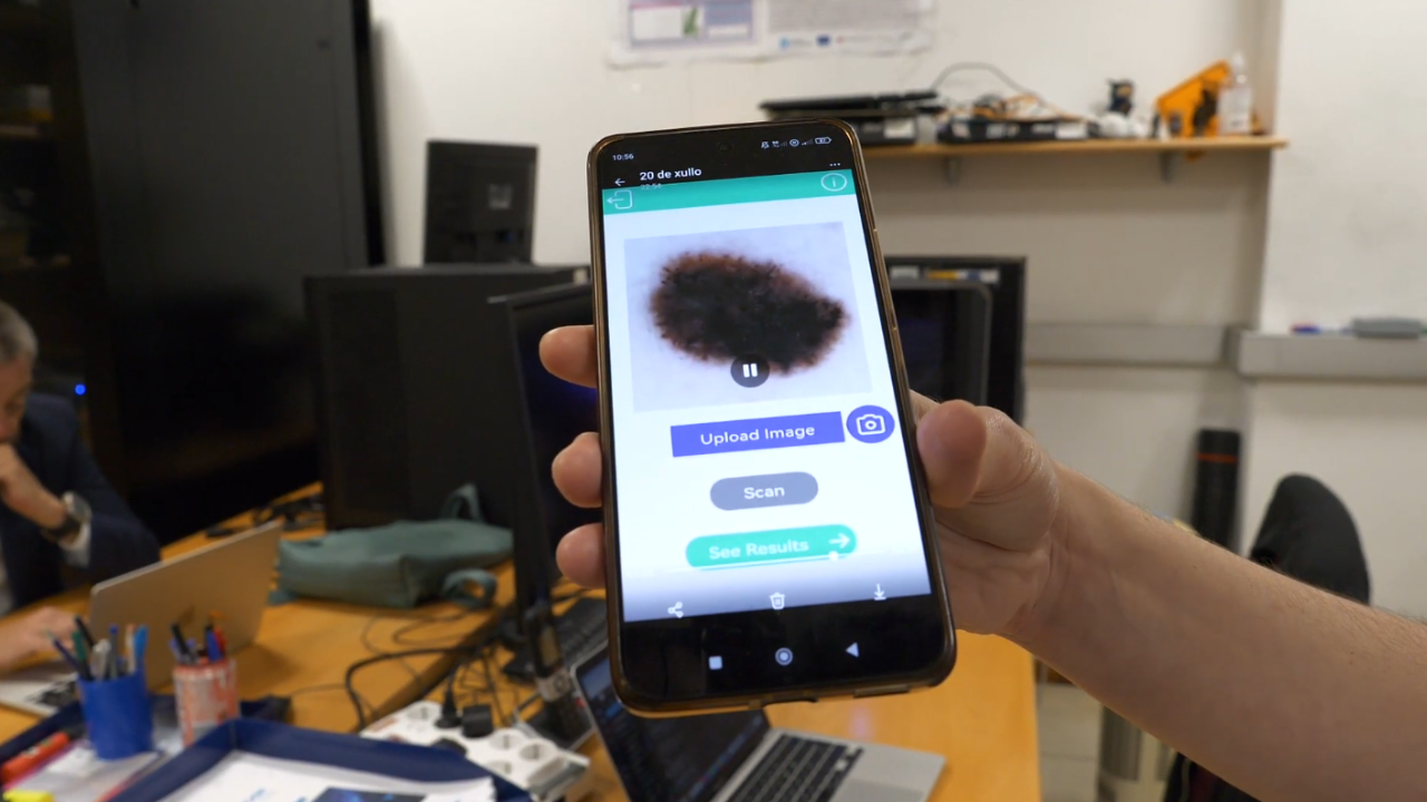 El laboratorio que hace posible detectar el melanoma con una fotografía gracias a la inteligencia artificial