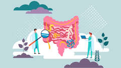 El c�ncer de colon es el m�s frecuente y el segundo m�s letal en todo el mundo.