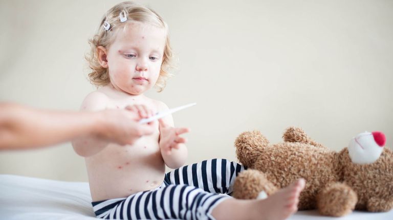 Un brote de sarampión por falta de vacunación deja ya nueve niños muertos en Israel