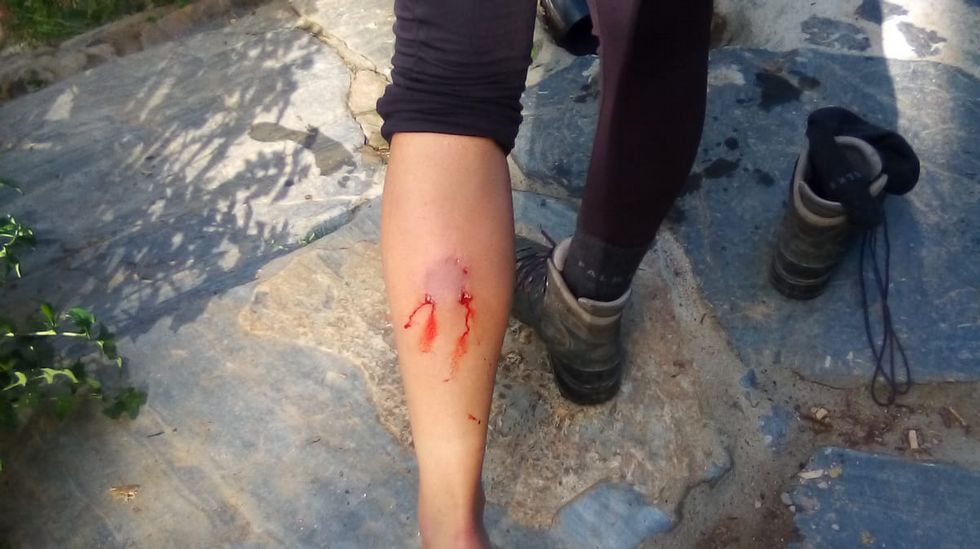 Leve el conductor de una hormigonera tras volcar en Samos.Sugar Drops act�a en el Clavic�mbalo