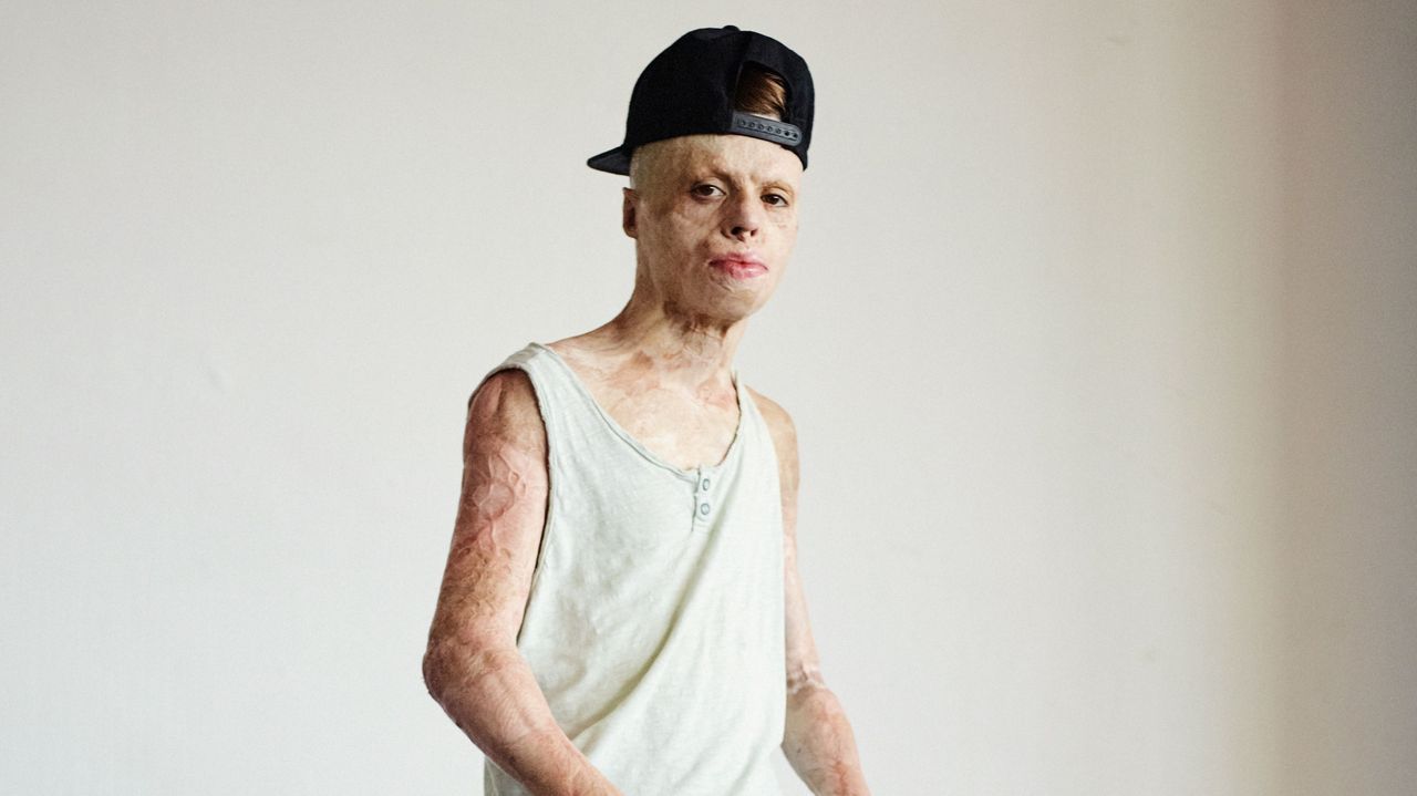 Joyas inmobiliarias con precios por encima del mercado.Aleixo Paz, protagonista del documental �El ni�o de fuego�, una gran historia de superaci�n