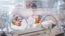 Un bebé prematuro en una incubadora, en una imagen de archivo