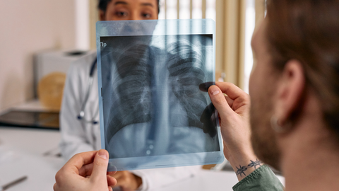 Los pulmones de la población han cambiado en las últimas décadas.