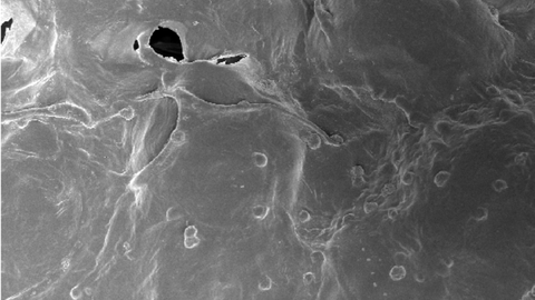 Imagen de un microscopio electrónico. Son las vistas del interior de un dispositivo flexible desarrollado con biopolímeros. Está cargado con linfocitos T modificados genéticamente.