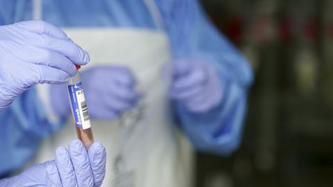 Un sanitario sostiene un muestra para realizar un análisis PCR 