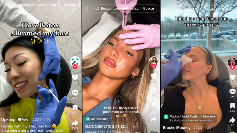 Crecen los procedimientos de medicina estética entre los jóvenes.