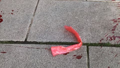 Restos de sangre en la calle