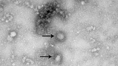 La secuencia genetica del coronavirus