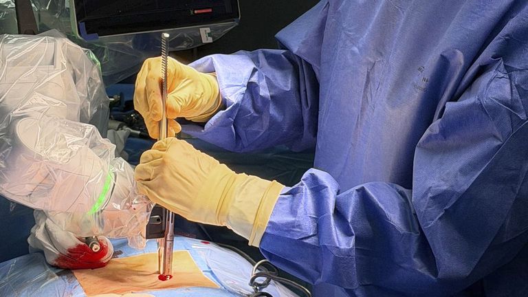 Vithas Vigo estrena su robot de neurocirugía en la operación de una hernia lumbar