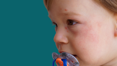 La dermatitis at�pica se caracteriza por picor en la piel y brotes de eczema cr�nicos.