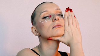 Estela a trav�s de su Instagram muestra su d�a a d�a con alopecia
