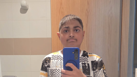 El joven Jony Montoya padece anemia de Fanconi