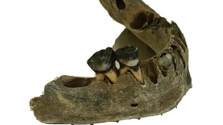 La sorpresa de Arealonga: restos humanos hallados en el yacimiento barreirense tienen más de 3.000 años