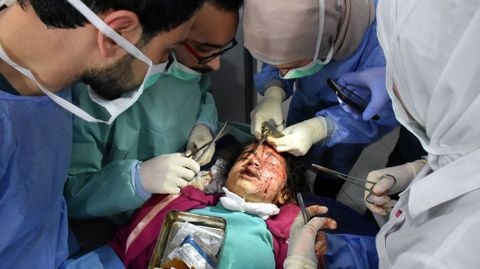 Heridos en el ataque de Alepo
