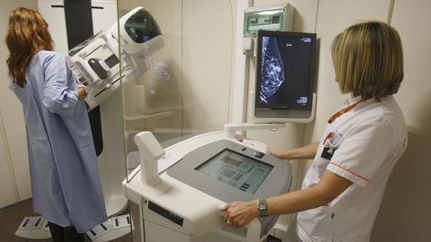 El 80% de las mujeres gallegas de más de 50 años participan en el programa de cribado de cáncer de mama