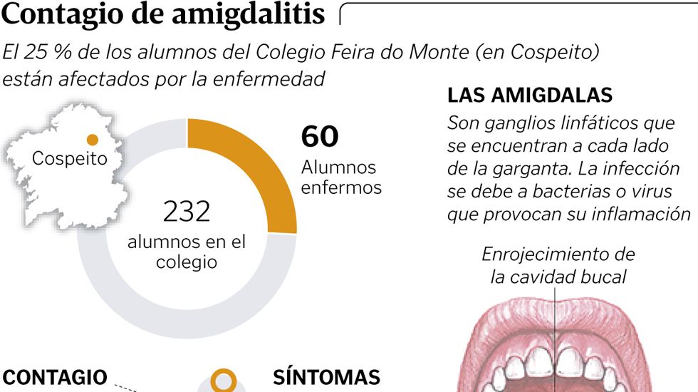 Contagio de amigdalitis