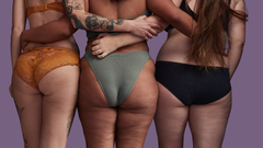 Se calcula que un 95 % de las mujeres padecer�n celulitis en alg�n momento de su vida.
