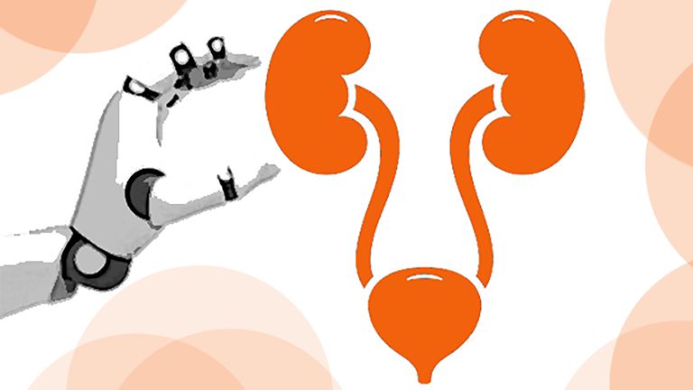 Un robot en urología: ¿por qué elegirlo frente a laparoscopia o cirugía abierta?