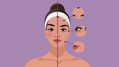 �Una arruga es el resultado de la contracci�n del m�sculo que hay inmediatamente debajo de la piel�, explican los expertos. 