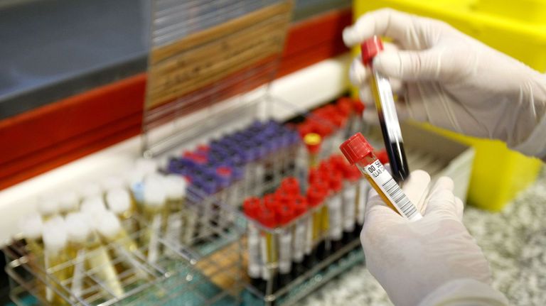 La lipoproteína A, el colesterol genético que mucha gente no sabe que tiene