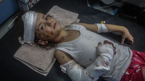 Un niño palestino, ayer en el hospital Al Shifa de Gaza, tras sufrir heridas severas por un ataque israelí.