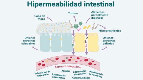 El proceso de hipermeabilidad intestinal por cual la barrera intestinal no funciona de forma correcta. 