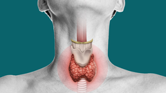 Los problemas en la regulación de la hormona tiroidea pueden darse por exceso o por falta de producción.