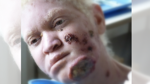 Leah camin tres das en Tanzania para llegar al hospital donde trabajaba Soto. Su cncer se haba extendido demasiado y falleci a los 28 aos.