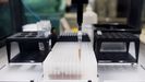 Pipetas con muestras para hacer PCR en el Hospital Gregorio Marañón, de Madrid
