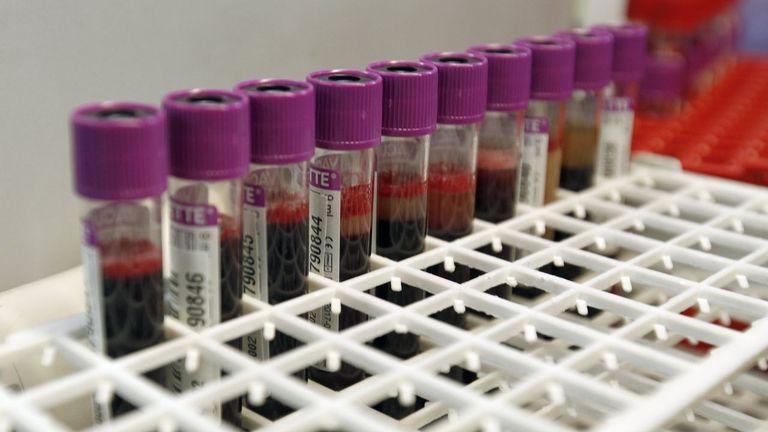 Por qué no nos tocan