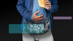 El s�ndrome de intestino irritable es un trastorno funcional cr�nico que afecta a entre un 10 y un 15 % de la poblaci�n.