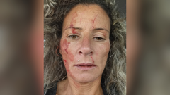 Mara, la vecina agredida en Fene