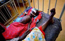 Imagen de un nio malnutrido tomada el pasado 24 de abril en un hospital Mogadiscio.