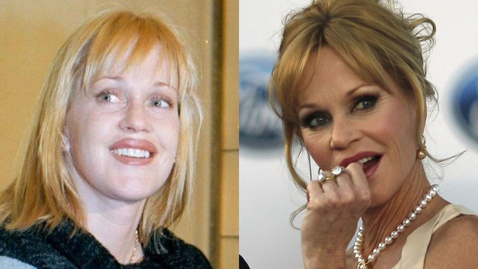 Melanie Griffith.El antes y despus de Melanie Griffith